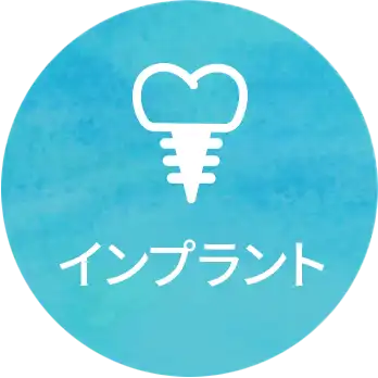 インプラント